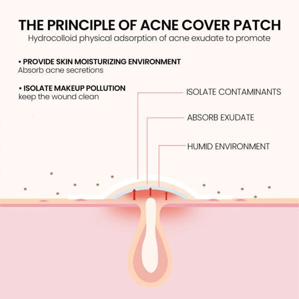 Pimple Patches,Pimple Patches For Face, Hydrocolloid Acne Patches, Cute Star Stickers Hydrocolloid Acne Pimple Patch For Covering Zits And Blemishes - Image 5
